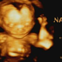 Futuras mamás Noviembre 2018! - 2