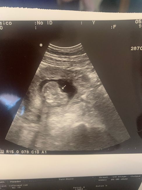 Futuras mamas octubre 2020 - 1