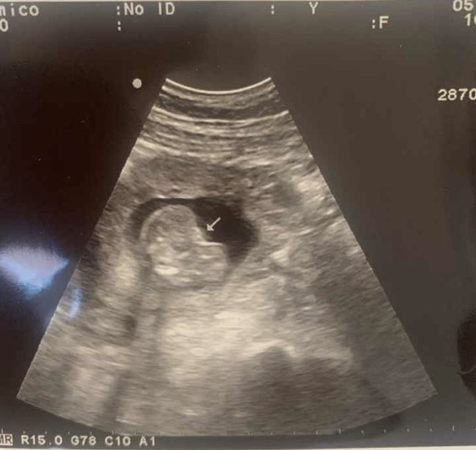 ¿Me ayudáis: niño o niña? 💙🌸 4