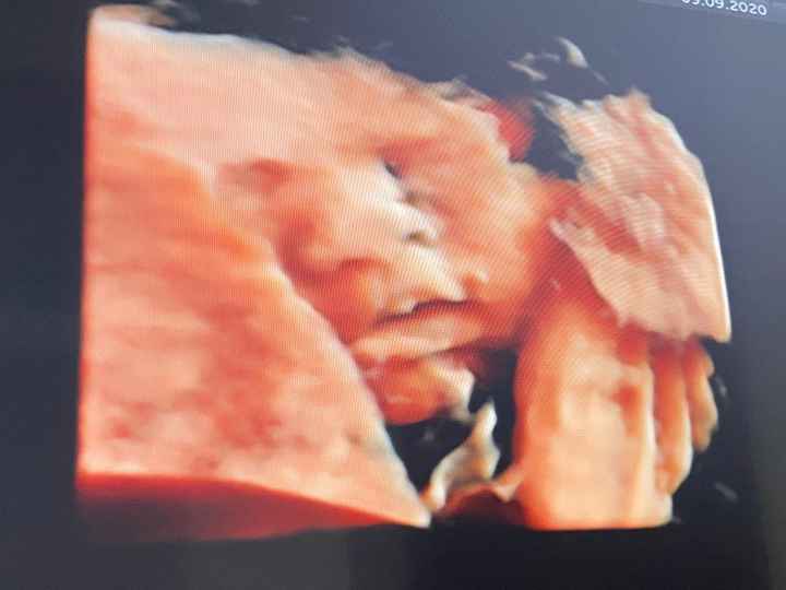 Futuras mamas octubre 2020 - 1