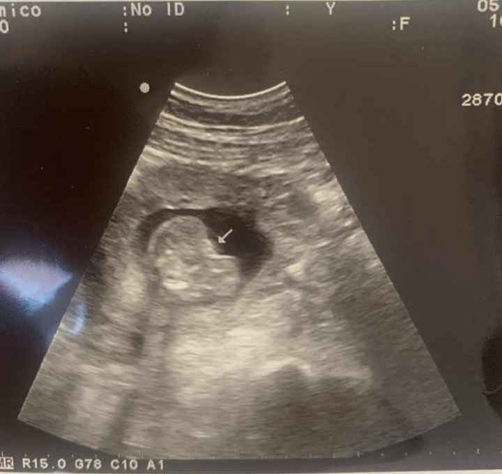 ¿Me ayudáis: niño o niña? 💙🌸 - 1