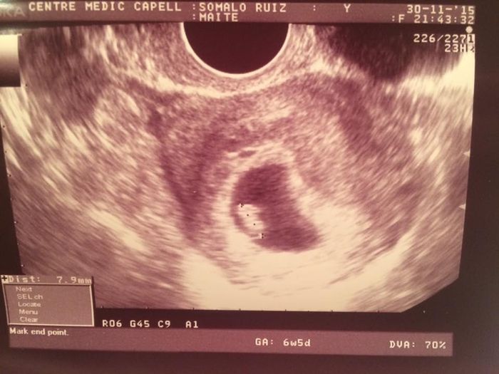 Ainsss mi cosita muero de amor 6+6
