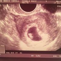 Ainsss mi cosita muero de amor 6+6