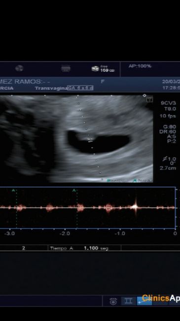 Nuevo! futuras mamis noviembre 2017 - 1