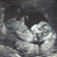 ¡nuevo! futuras mamis marzo 2018 - 1