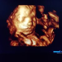 ¡nuevo! futuras mamis marzo 2018 - 1