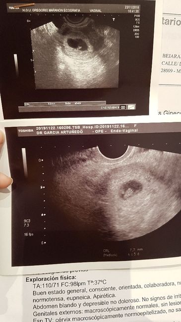 Ayuda con método ramzi: niño o niña? 1
