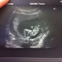 El consultorio de Lita para futuras mamis - 1