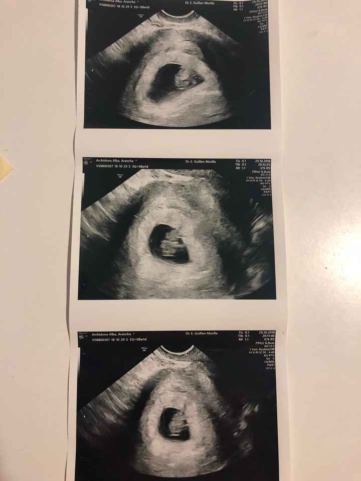 Futuras mamás Junio 2019 - 1
