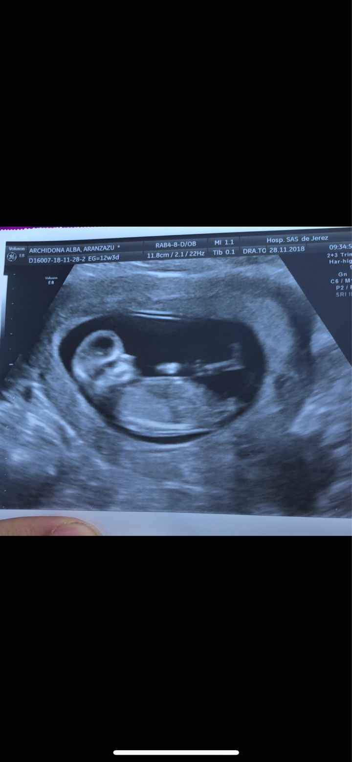 Futuras mamás Junio 2019 - 1