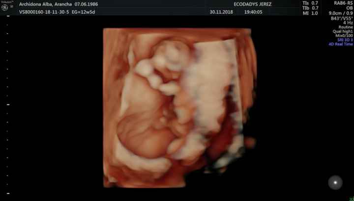 Futuras mamás Junio 2019 - 1