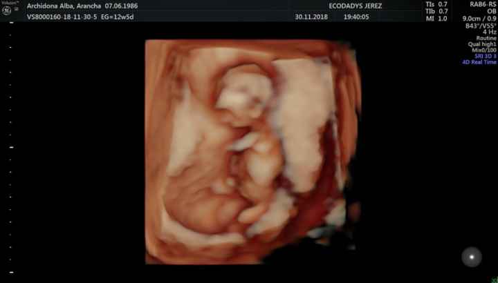 Futuras mamás Junio 2019 - 2