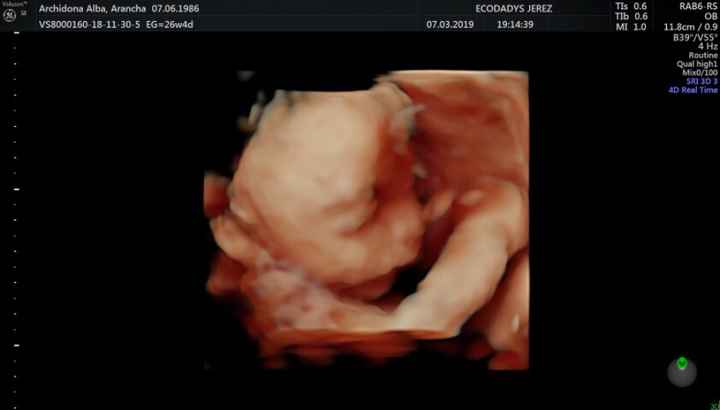 Futuras Mamás junio 2019 - 3