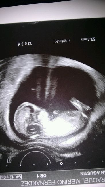 ¡¡futuras mamás agosto 2016!! - 2