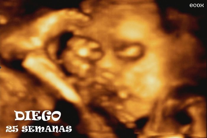 ¡¡futuras mamás agosto 2016!! - 1