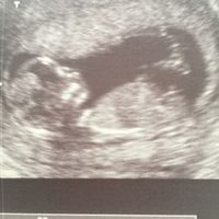 El consultorio de Lita para futuras mamis - 1