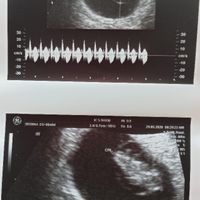 Futuras Mamis Enero 2021 - 1