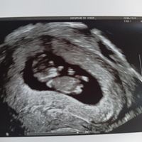 Futuras Mamis Enero 2021 - 1