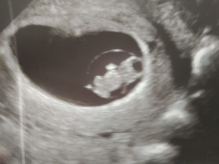 Futuras Mamas Julio 2020. - 1