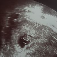 Futuras mamás Agosto 2021 - 1