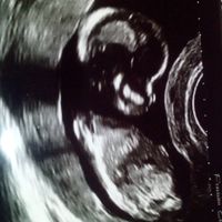 El consultorio de Lita para futuras mamis - 1