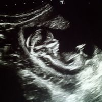 El consultorio de Lita para futuras mamis - 2