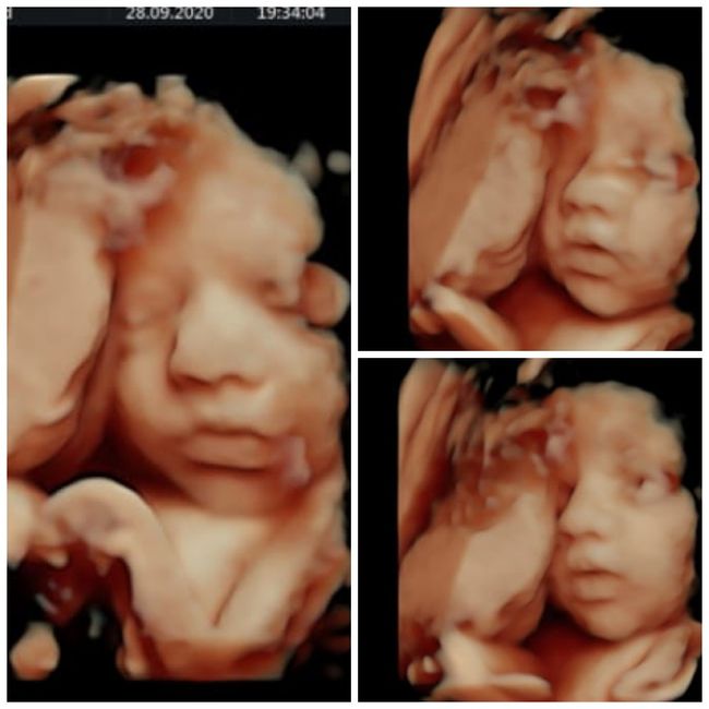 Futuras mamas Diciembre 2020 - 1