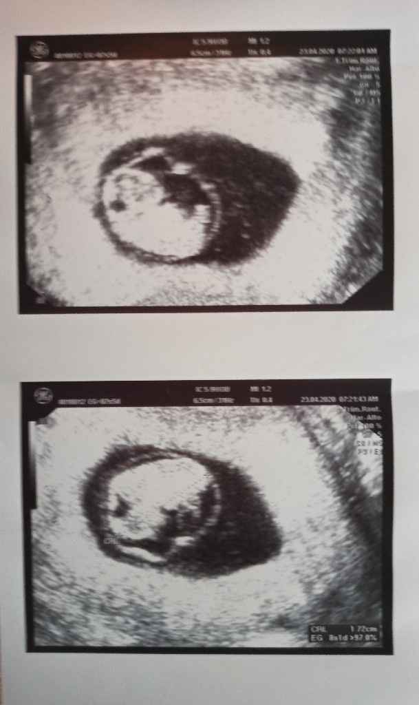 Futuras mamas Diciembre 2020 - 1