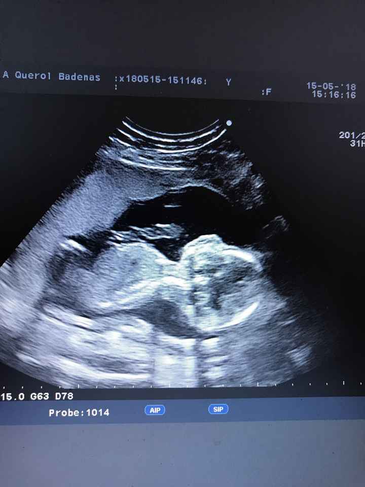 Futuras mamás Octubre 2018!!! - 1