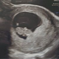 Futuras mamás Mayo 2021🤰♥️ - 1
