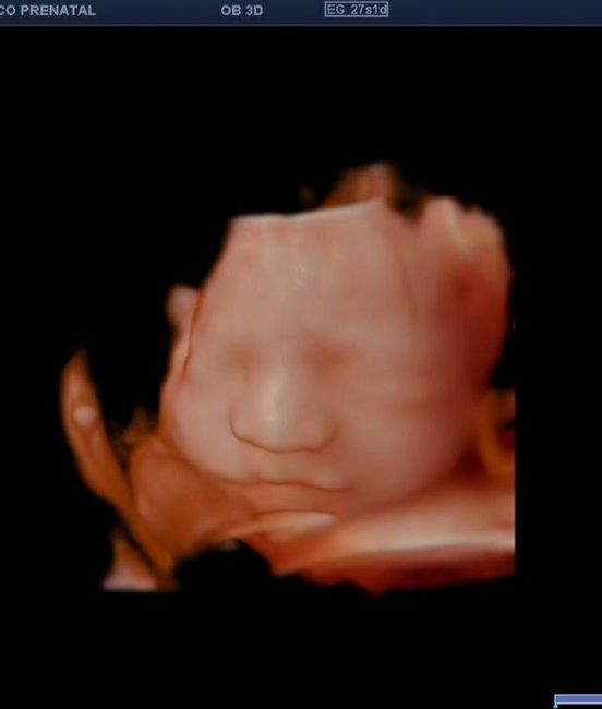 Futuras Mamás Junio 2020 v2.0 - 1