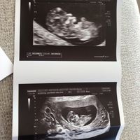 Futuras mamis mayo 2023 - 1