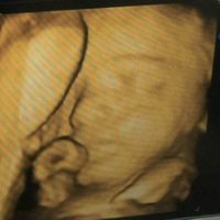 Futuras mamas julio 2016 - 1