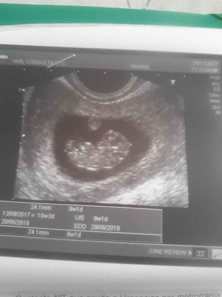  Futuras Mamis Julio 2018 - 1