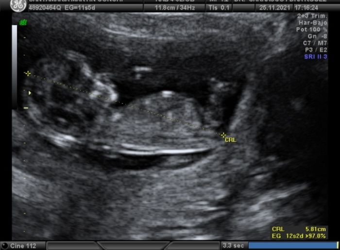 Futuras mamis Junio 2022!! - 1