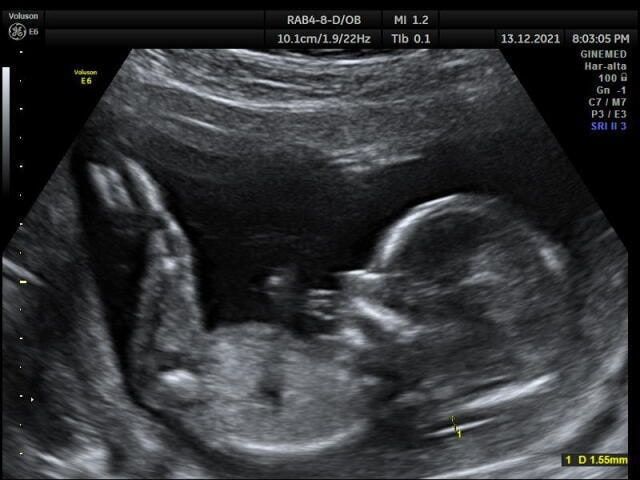 Futuras mamis Junio 2022!! - 1