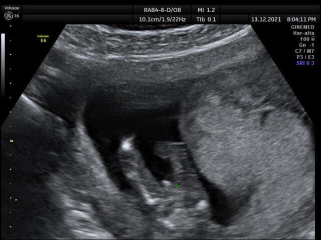 Futuras mamis Junio 2022!! - 2