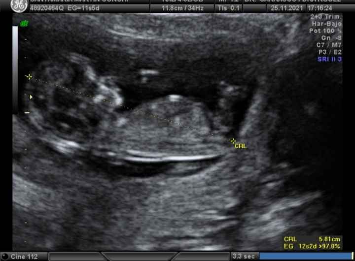 Futuras mamis Junio 2022!! 1