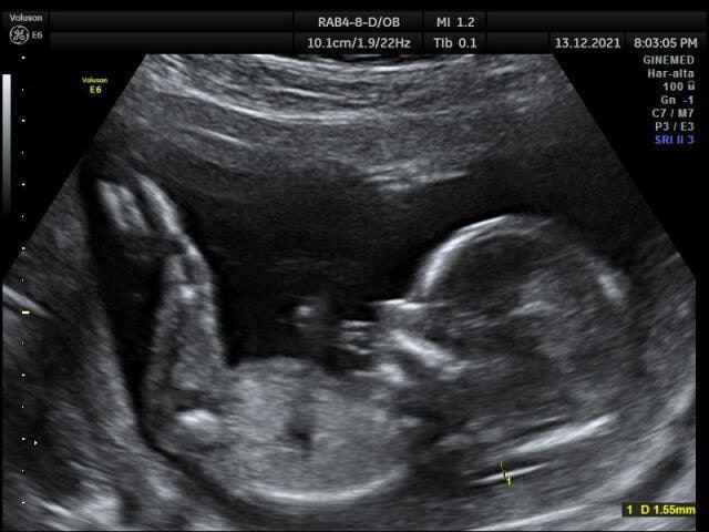 Futuras mamis Junio 2022!! 2