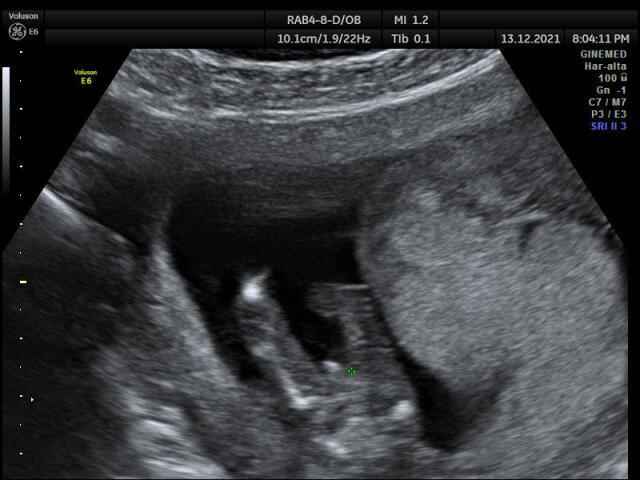 Futuras mamis Junio 2022!! 3
