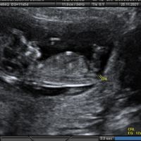 Futuras mamis Junio 2022!! - 1