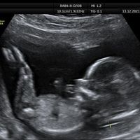 Futuras mamis Junio 2022!! - 1