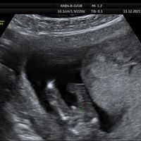 Futuras mamis Junio 2022!! - 2