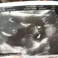 El consultorio de Lita para futuras mamis - 1