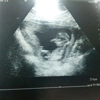 El consultorio de Lita para futuras mamis - 1