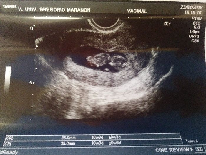 Futuras mamás Noviembre 2018! 2