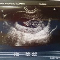 Futuras mamás Noviembre 2018! - 1