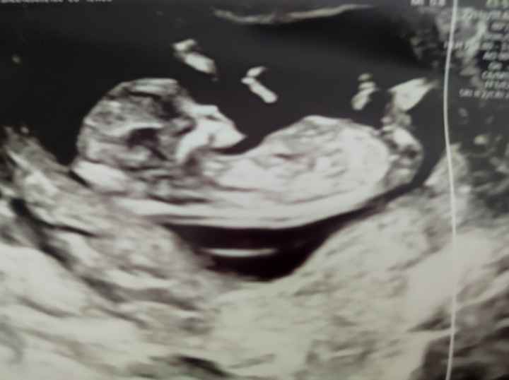 Futuras mamás Abril 2023 (actualizado) - 1