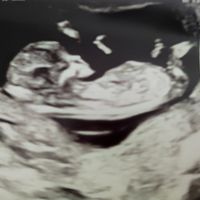 Futuras mamás Abril 2023 (actualizado) - 1