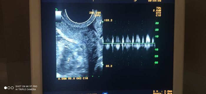 👶🏻futuras mamis febrero 2022👶🏻 2